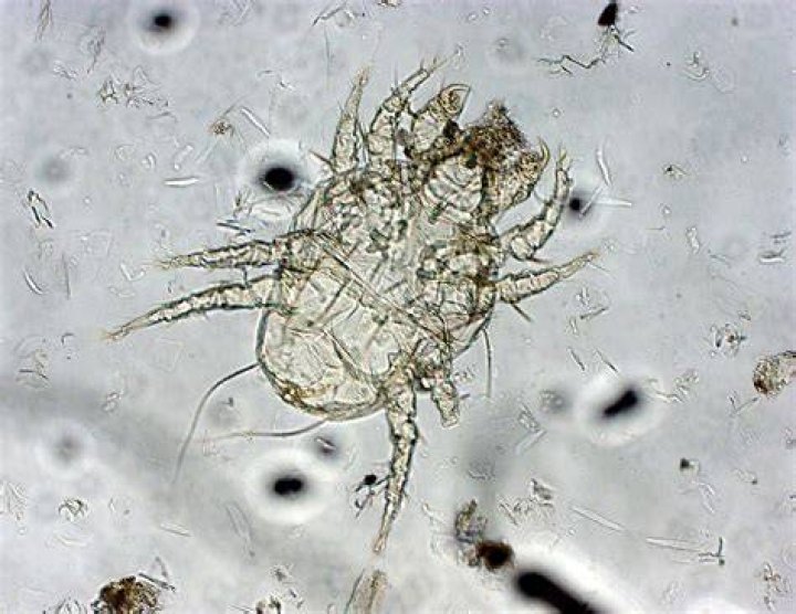 What&rsquo;s Eating You? Cheyletiella Mites MDedge Dermatology
